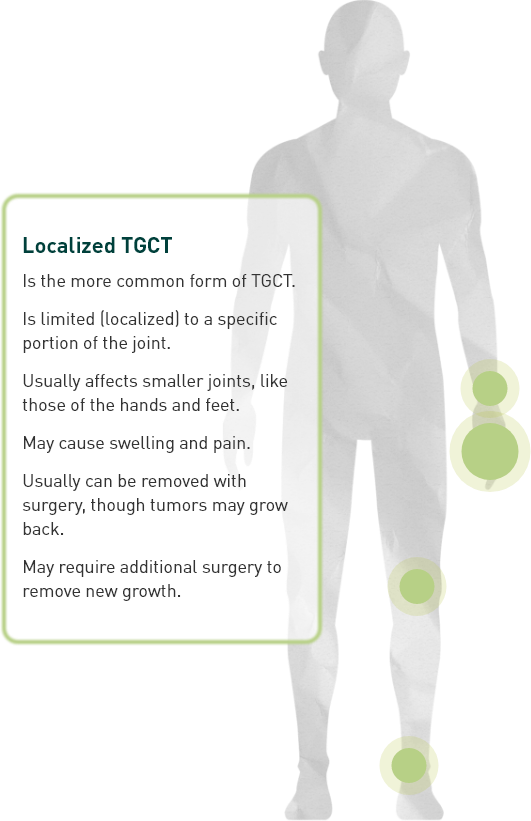 Image representing common locations of localized TGCT in the body